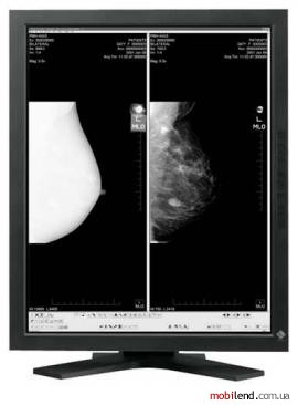 Eizo RadiForce G51