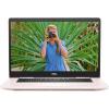 Dell Inspiron 15 7570 Pink (7570-0003)