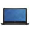 Dell Inspiron 3567 (I353410DIL-51S)