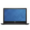 Dell Inspiron 3567 (I35H345DIL-6BK) Black