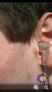 ��������� SonyEricsson X10